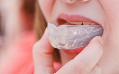 Mouthguards As a Preventive Measure Against Dental Emergencies