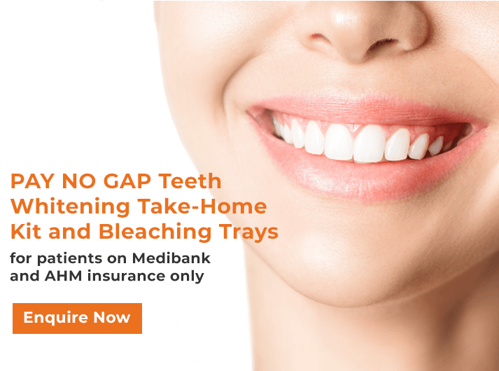 pay-no-gap-teeth-whitening-banner-cabramatta