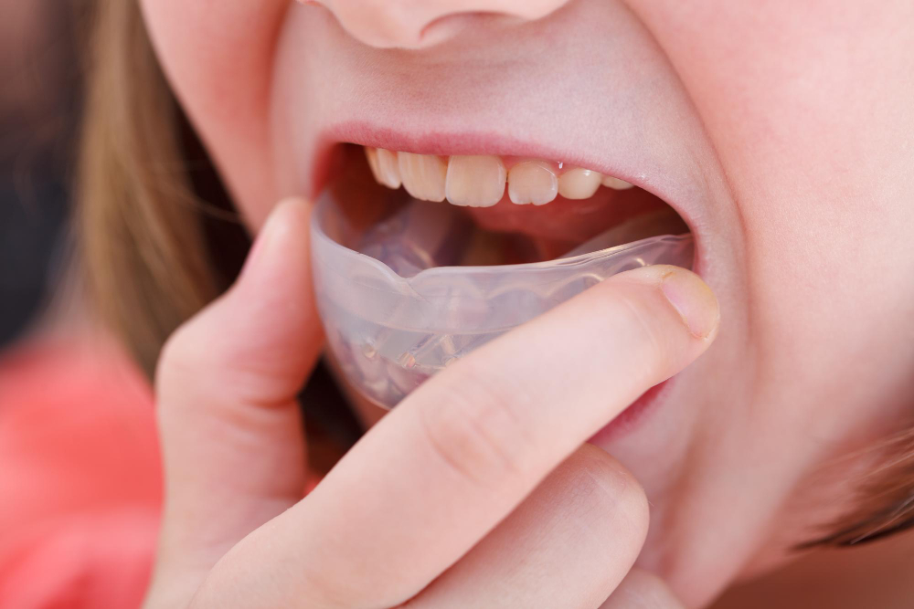 at-home care for mouthguards cabramatta