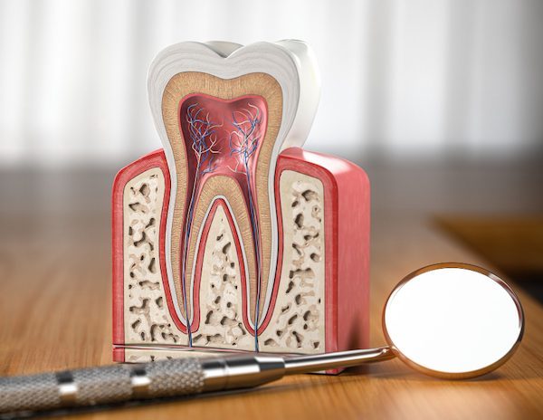 benefits of root canal treatment cabramatta