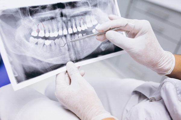 dental x-rays blurb cabramatta