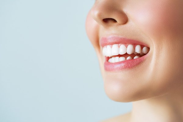 teeth whitening blurb cabramatta