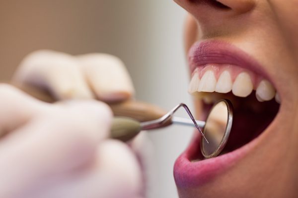 what you can expect oral cancer examination cabramatta