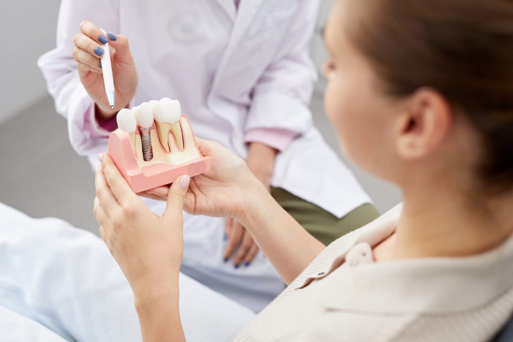 how bone grafting strengthens your dental implant journey