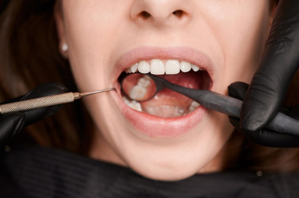 how root canals rescue teeth from pain and infection